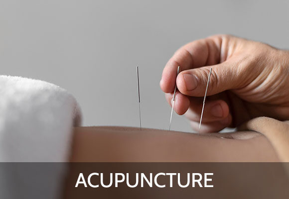 Acupuncture