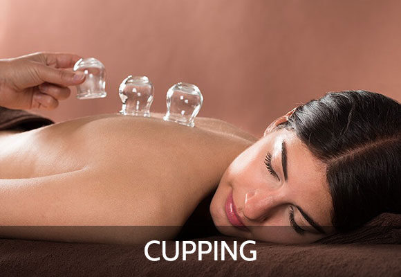 Cupping